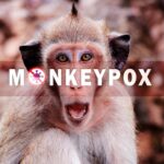 Monkey with "Monkeypox" text overlay.