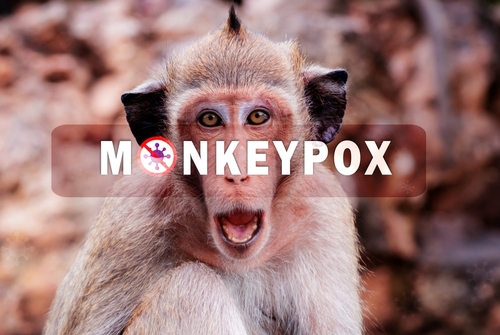 Monkey with "Monkeypox" text overlay.